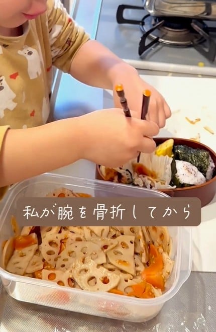 5NŁA2΂̒킳̂߂ɕٓ5΂Z