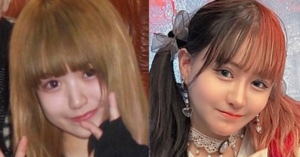 きゅ整形垢 整形アイドル”プロデューサー、自身の整形に2500万円以上をかけて